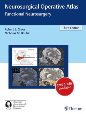 Neurosurgical Operative Atlas: Functional Neurosurgery