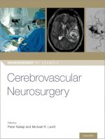 Cerebrovascular Neurosurgery (Neurosurgery by Example)