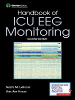 Handbook of ICU EEG Monitoring - 2nd Edition