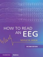 How to Read an EEG - 2nd Edition