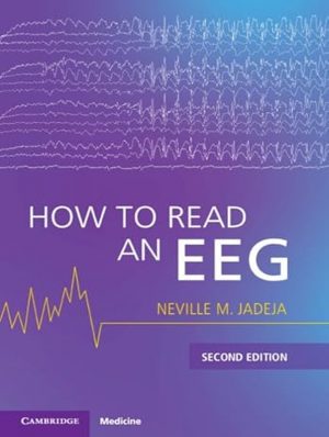 How to Read an EEG - 2nd Edition